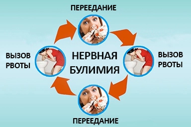 Лечение булимии в Любинском